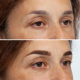 Фото бровей до и после